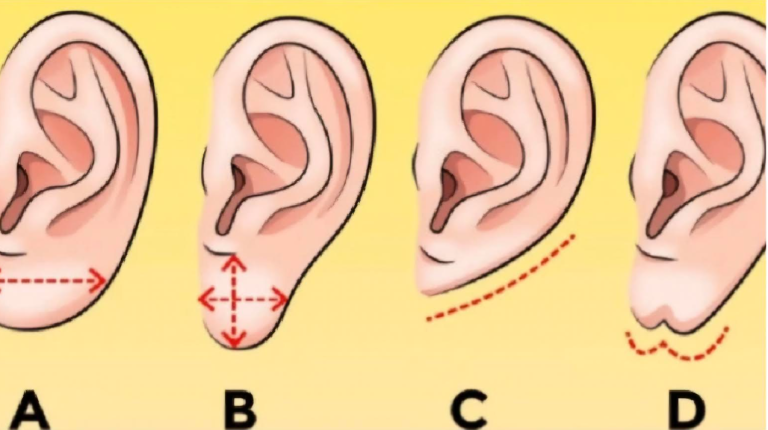 A füled formája elárulja az igazi személyiségedet - A tied milyen?