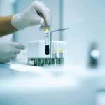 Milyen laborvizsgálatok segítenek a szezonális betegségek ellen?