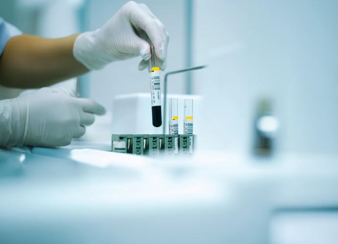 Milyen laborvizsgálatok segítenek a szezonális betegségek ellen?